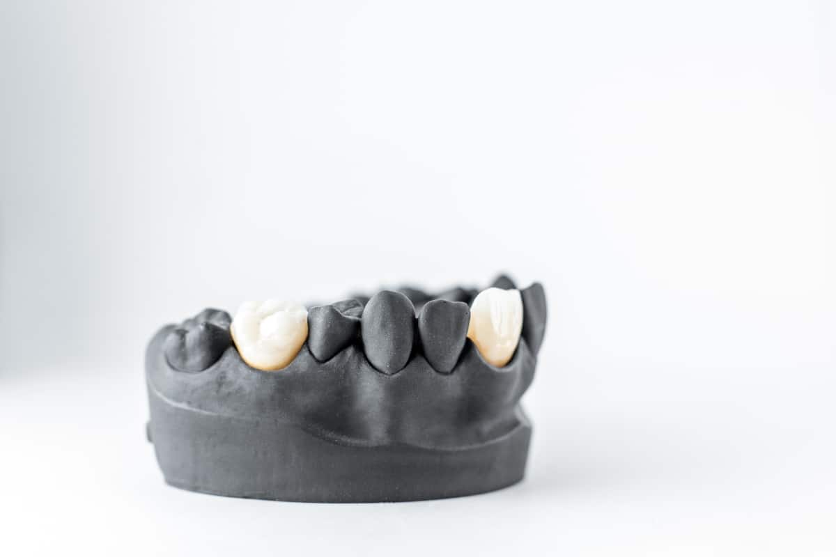 Dental Crowns Nashville